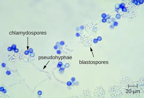 Pseudohyphae, chlamydospores and blastospores of Candida yeast.