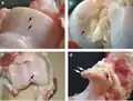 Damaged cartilage from sows. (a) cartilage erosion (b) cartilage ulceration (c) cartilage repair (d) osteophyte (bone spur) formation.