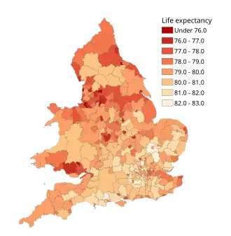 Life expectancy at birth for boys in 2012-2014 by local authority district in England and Wales.
