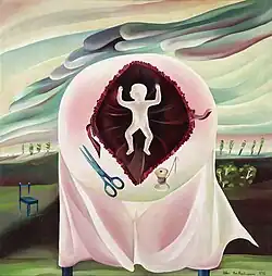 Section (Caesarean), 1976, oil, 100x100cm