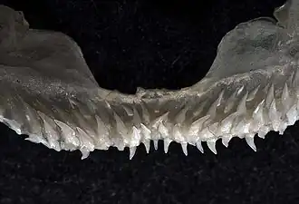 Upper teeth