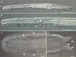 Grayscale differential interference contrast photo micrograph showing ventral view of whole body, anterior region and posterior region