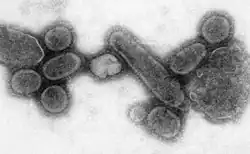 Transmission electron micrograph of influenza A viruses