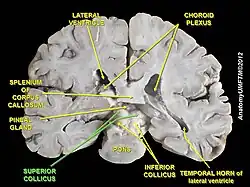 Superior colliculus (coronal section)