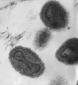 This transmission electron micrograph depicts a number of smallpox virions. The "dumbbell-shaped" structure inside the virion is the viral core, which contains the viral DNA; Mag. = ~370,000×