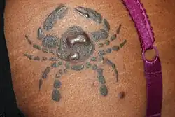 Keloid formation triggered by tattooing