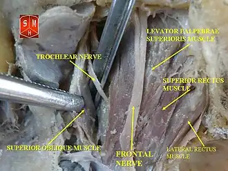 Levator palpebrae superioris muscle
